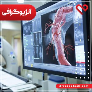 آنژیوگرافی چیست؟